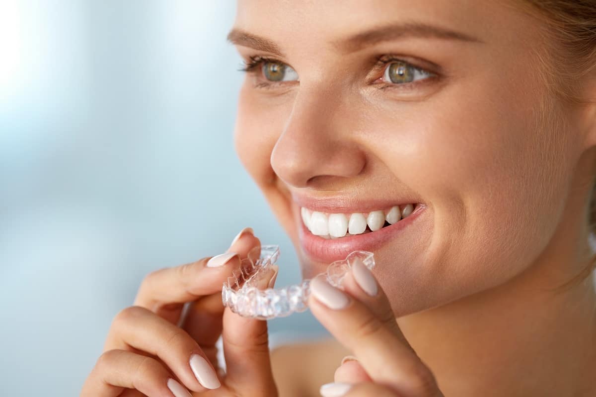 İnvisalign - 1